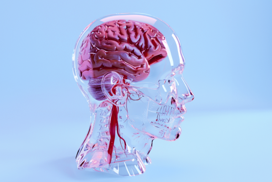 Программа «Инсульту нет»